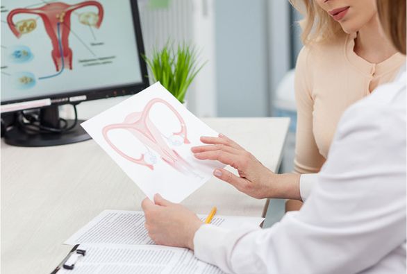 Mioma uterino pode atingir 80% das mulheres em idade fértil