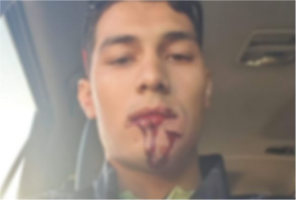 Ciclista é atropelado na BA-148