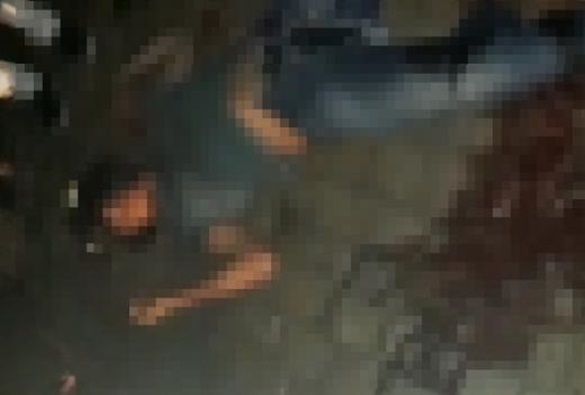 Em Livramento motociclista bate em lateral de caminhão e fratura a perna