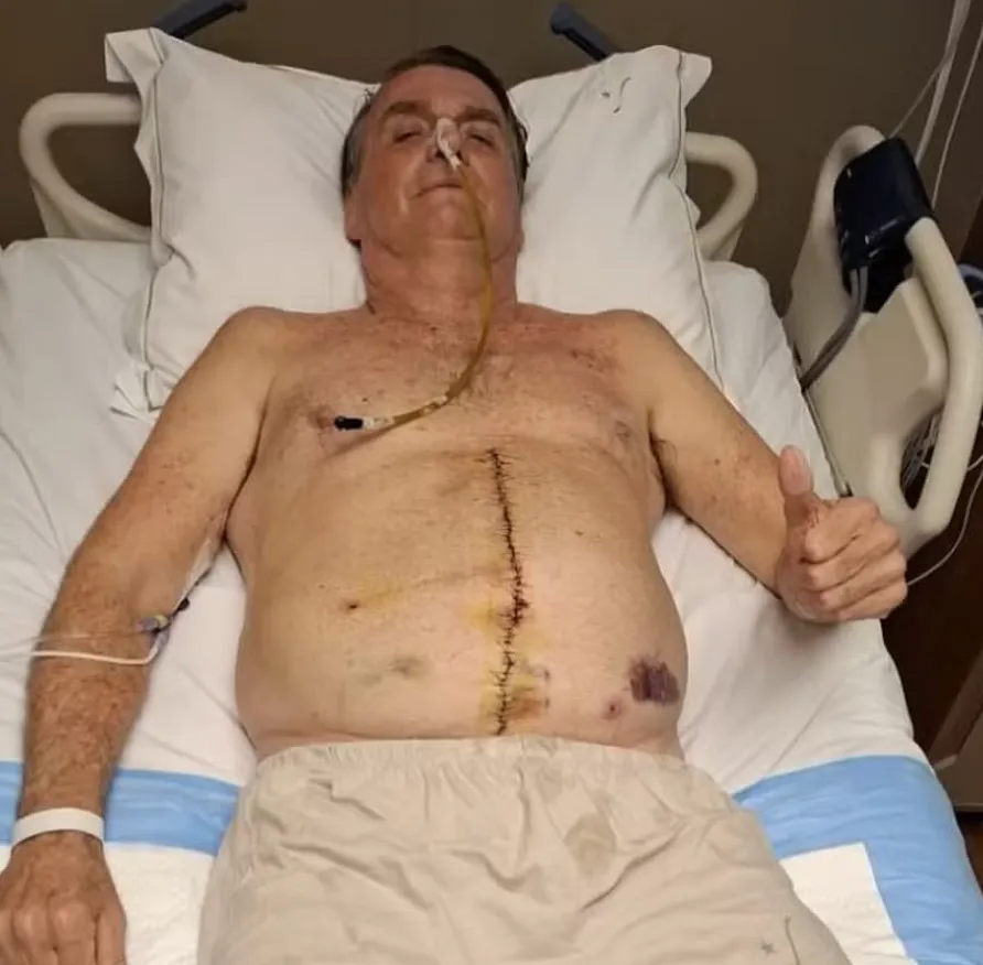 Jair Bolsonaro apresenta piora clínica e segue internado na UTI