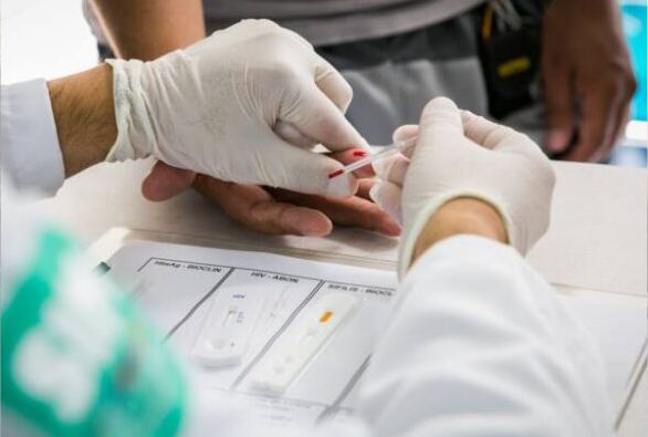 Casos de AIDS diminuíram 56% na Bahia em 2022; Diagnóstico precoce é essencial