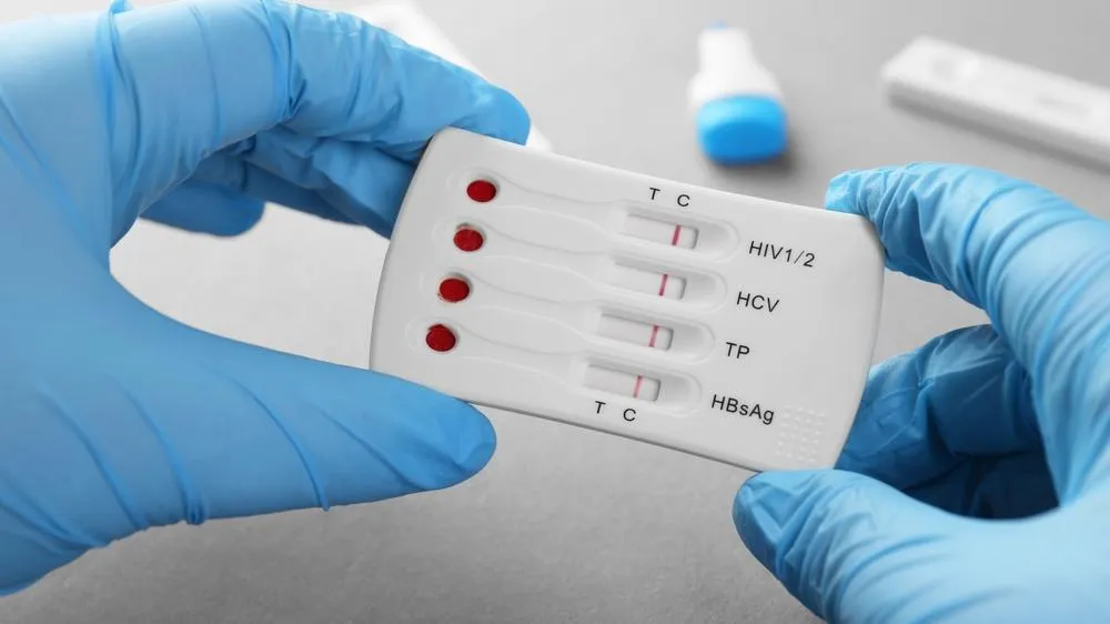 Nova variante do HIV é detectada em três estados do Brasil