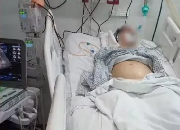 Grávida com morte cerebral é mantida viva por aparelhos para bebê sobreviver