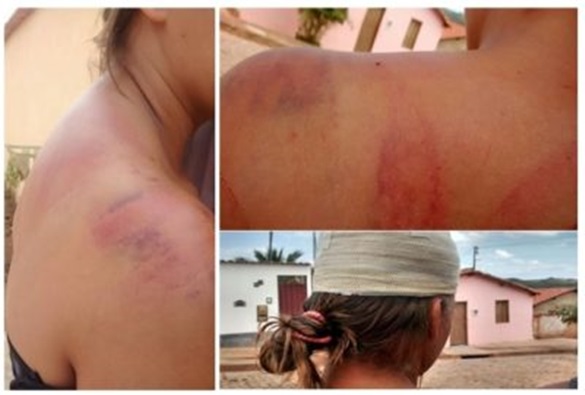 Jovem que foi espancada por casal em Rio de Contas, terá que fazer tomografia de crânio
