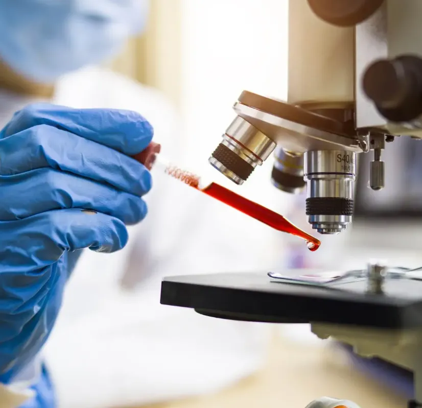 Cientistas brasileiros desenvolvem exame de sangue para auxiliar no diagnóstico precoce do câncer de mama