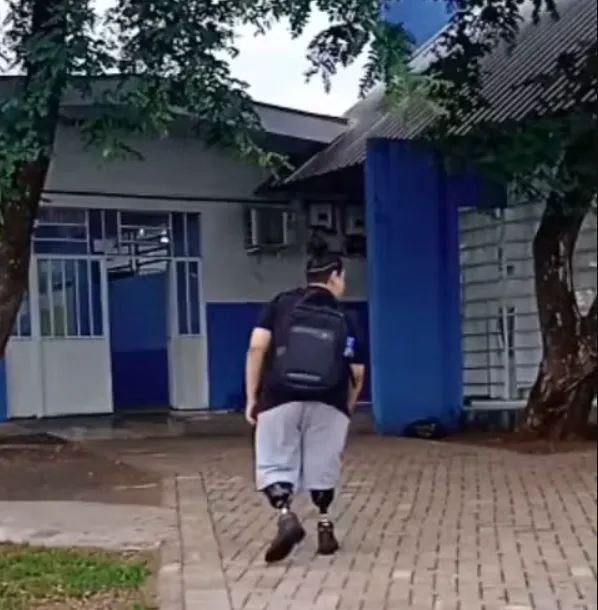 Menino cai de skate, rala pernas, contrai infecção e tem membros amputados