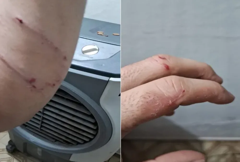 Jornalista entra em luta corporal com pitbull para salvar seu cachorro em Guanambi