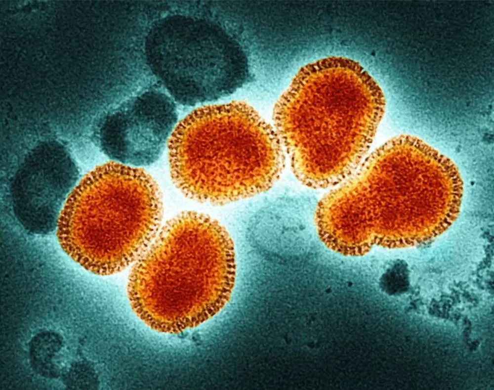 Brasil confirma quatro casos do subclado K da Influenza A (H3N2)