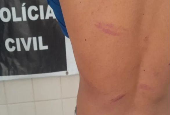 Aluno é espancado com socos, chutes e pauladas por colegas na saída da escola em Brumado
