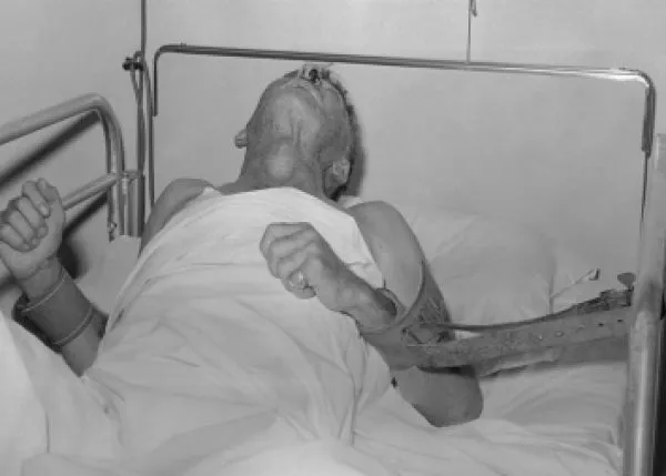 Ministério da Saúde emite alerta nacional após caso de raiva humana