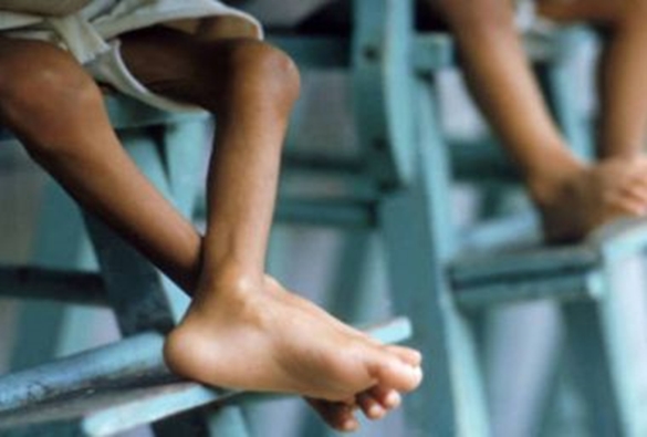 Desnutrição pode matar mais de 20 mil crianças na Somália, alerta ONG