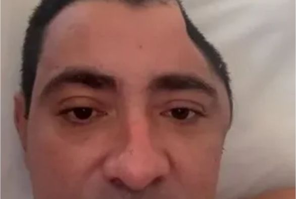 Homem se recupera e acorda do coma após receber mais de 18 tiros