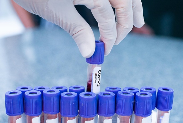 Testes para Covid-19 são ampliados para o interior e o governo da Bahia anuncia maior volume de exames 