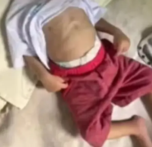 Bebê morre em Barra do Choça com sinais de agressões e desnutrição