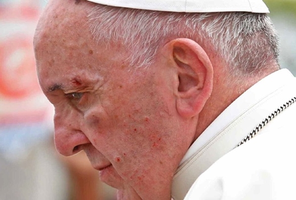 Papa é ferido no rosto durante passagem por Cartagena